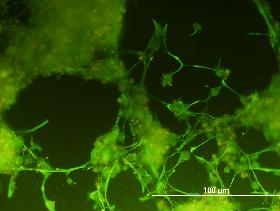 Obarvené neurodiferencované myší kmenové buňky pomocí nepřímé imunofluorescence